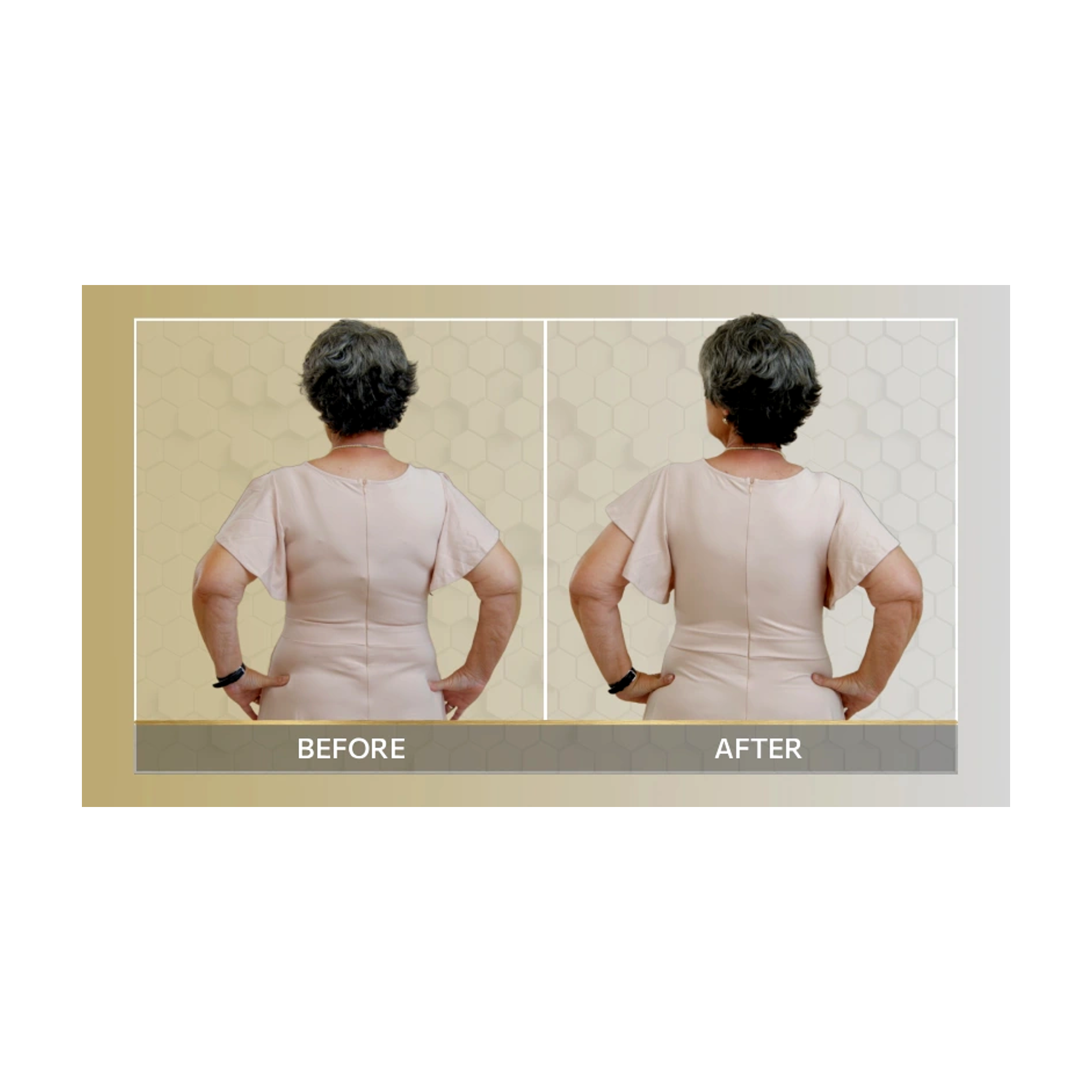 MisSlim Bra - Wireless Comfort Bra (Back-Smoothing Fit)